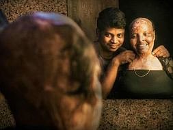 In the name of love for acid attack survivor Rani
