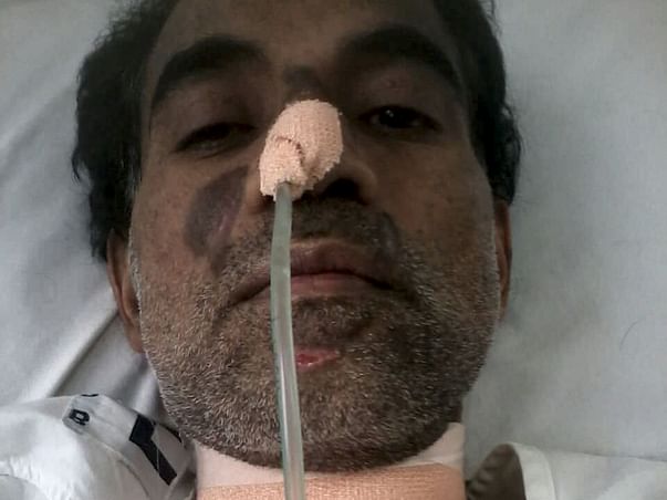 Help alfred lobo from Brain stroke