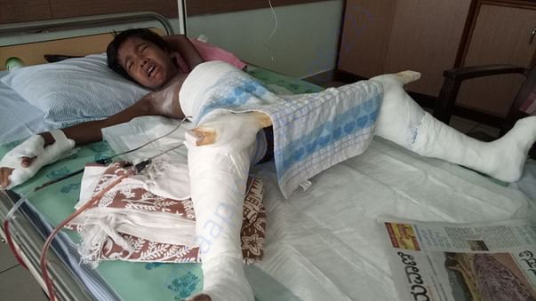 After surgery