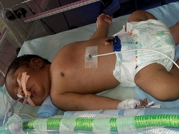 Save New Born Child Of Sankar Ramajayam Having Cardiac Issues