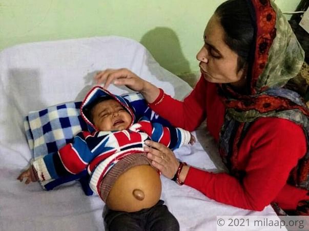 Help This 6-Month-Old Baby Girl Whose Belly Is Bloating Every Second
