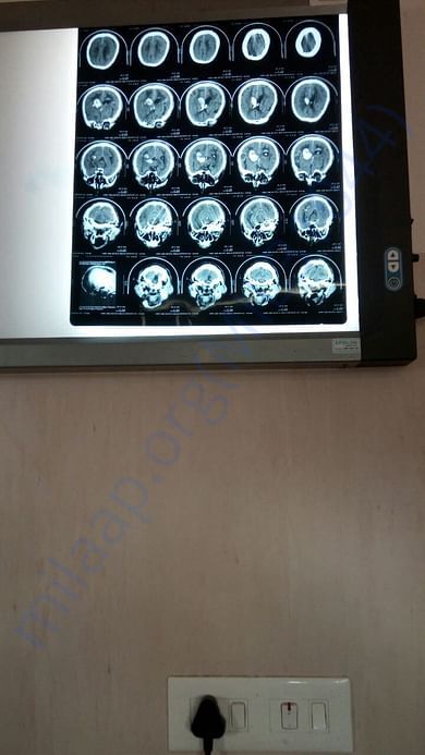 CT scan report