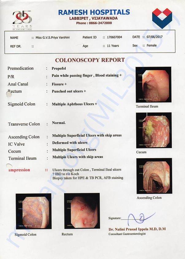 Colonoscopy Report