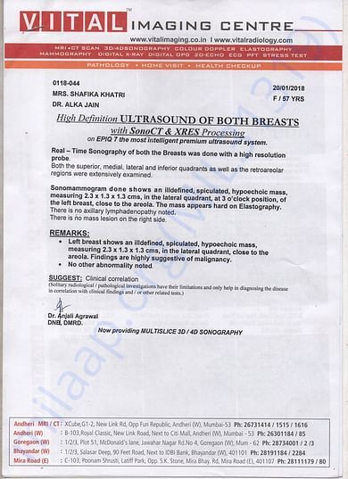 Ultrasound Report Of Both Breasts