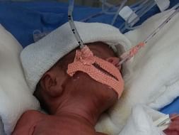 Help Madhurupam's Premature Twins Who Are Fighting For Their Life