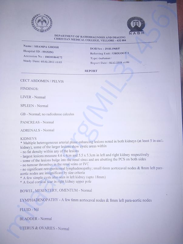 CT scan report from CMC giving numbers and dimensions of tumours