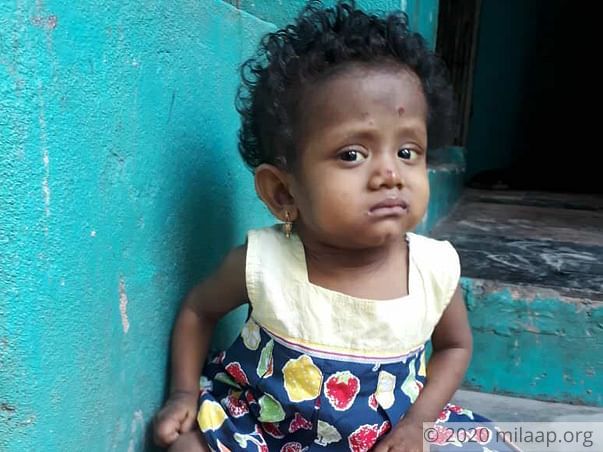 Help Baby Joshna Fight A Painful And Fatal Liver Disease