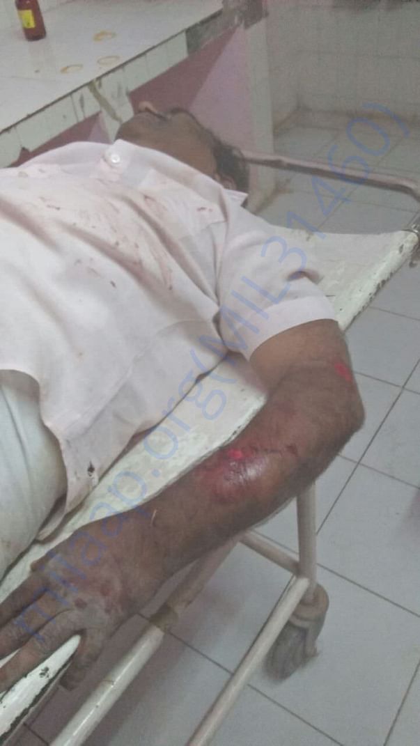 accident photo