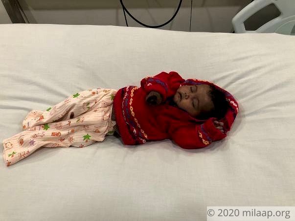 Help 3-month-old Gunjan fight a severe heart disease
