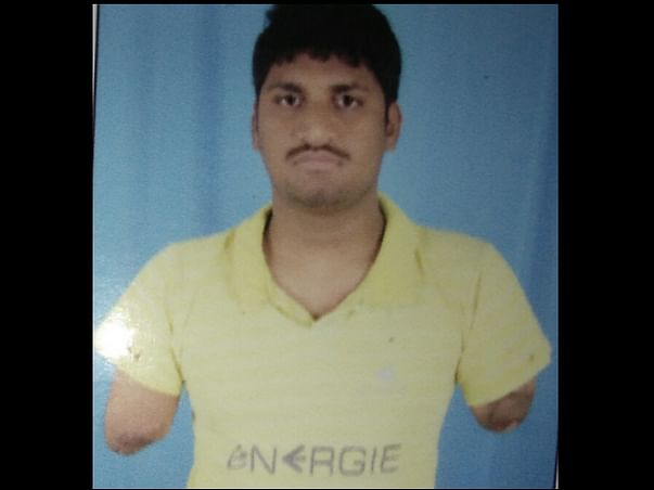 Help Srini To Have His Hands Transplanted