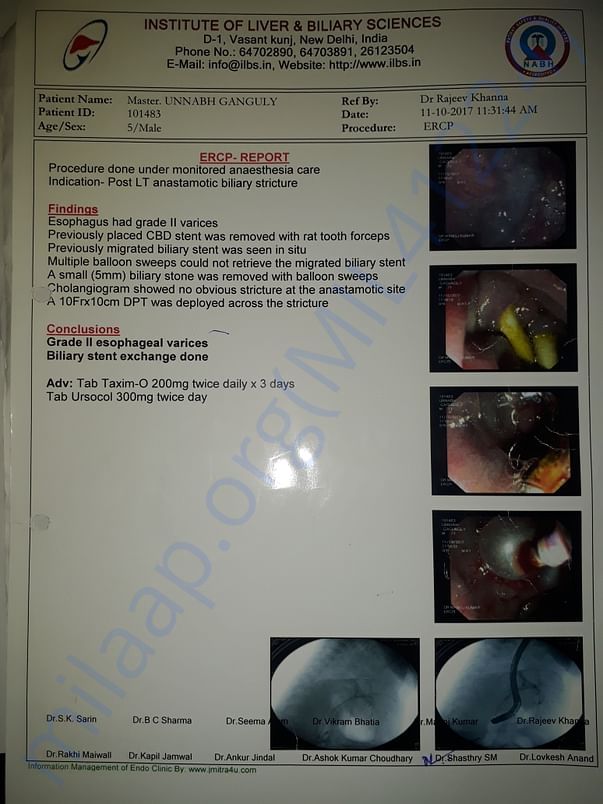 Last ERCP
