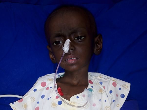 Help Dhruvankur for bone marrow transfer treatment