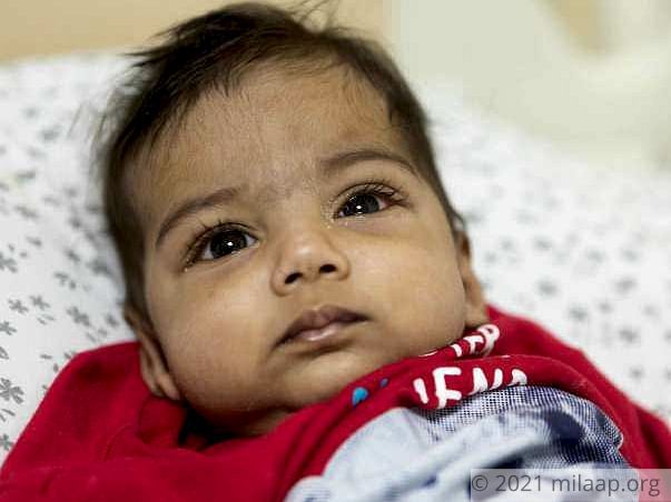 This 6-month-old baby boy is fighting a severe liver disease
