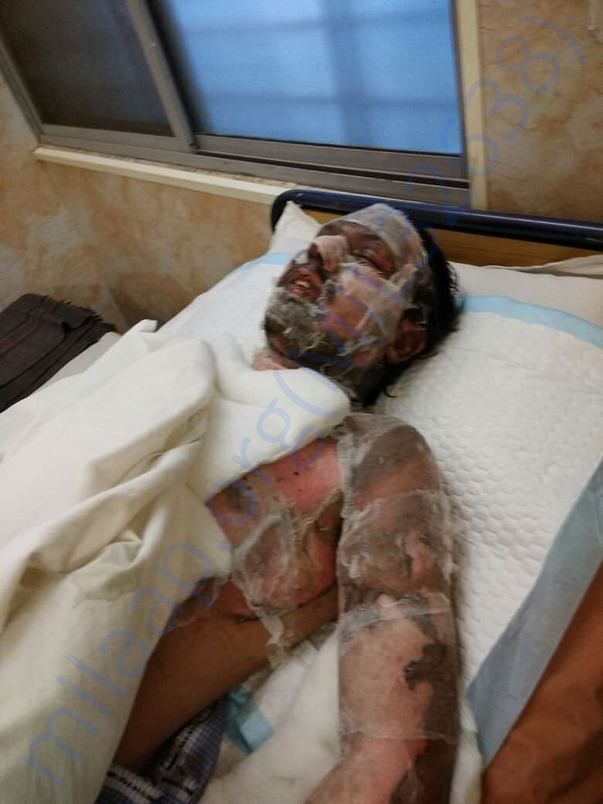 Pradeep Nayak on ward bed