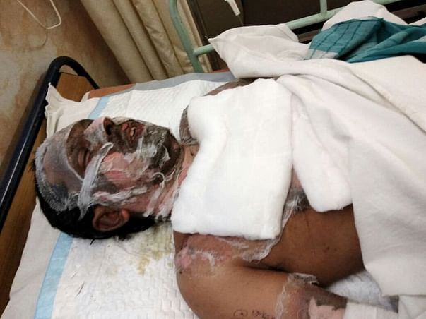 Help Pradeep Nayak(29 Yr) To Fight The Battle For His Life