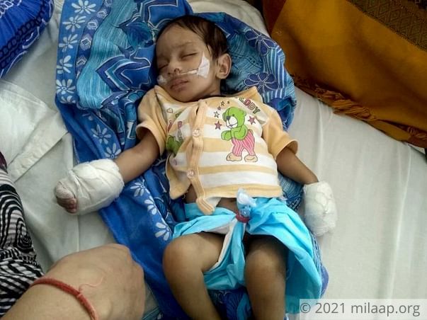 This 2-month-old baby needs an urgent heart surgery to survive