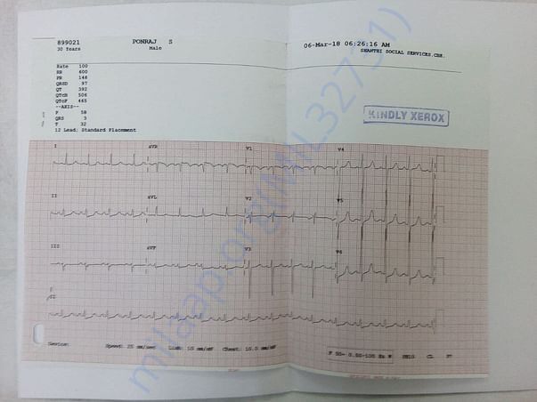 Kidney transplantation