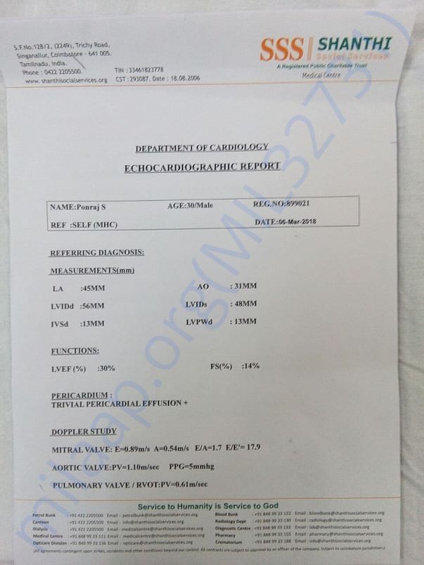 Kidney transplantation