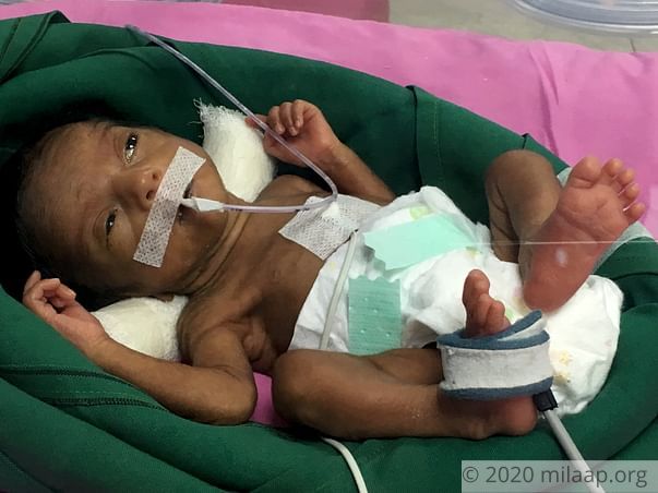 Help Priyanka Deshmukh save her premature twin babies