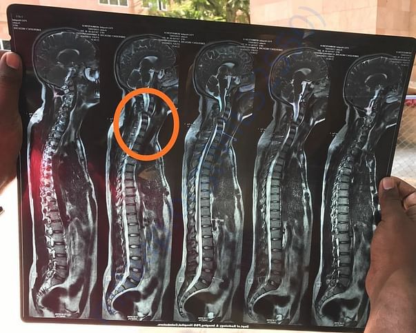MRI report