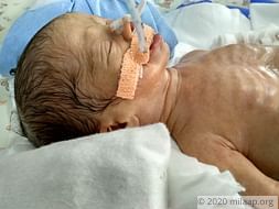 Help Priya save her premature twins