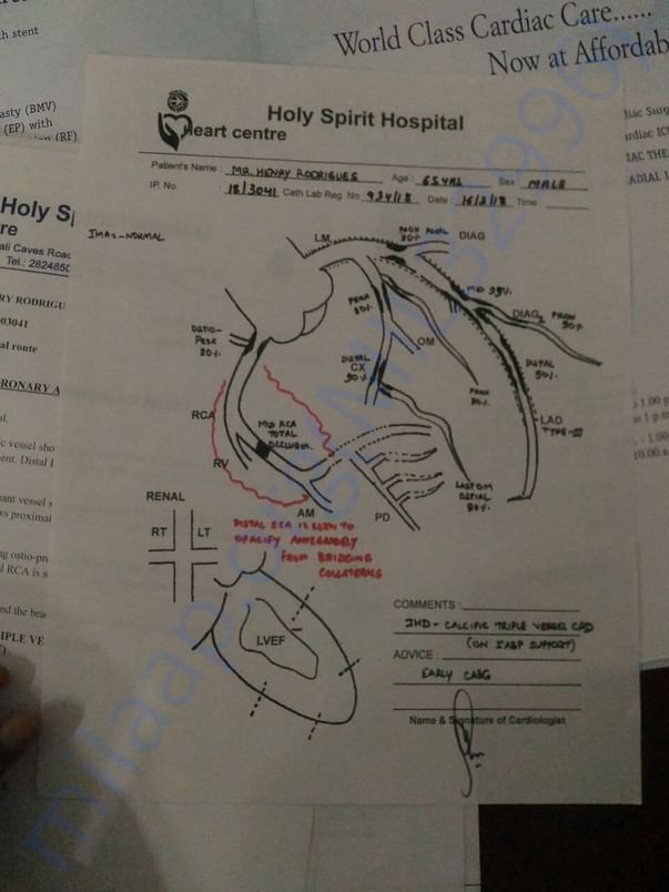 Schematic diagram depicting heart blockages