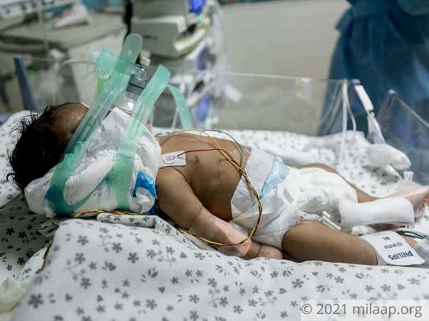 Help this 1-month-old boy who is fighting for his life