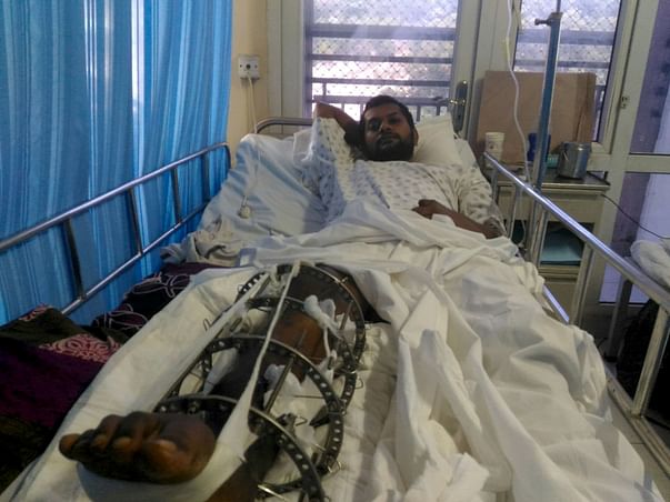 Cancer affected leg broken into pieces.