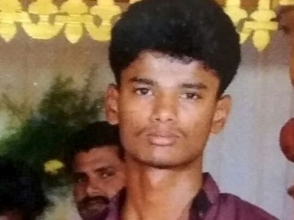 Help Hariprasath Skull Operation