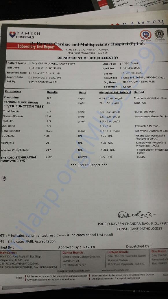 Test condition