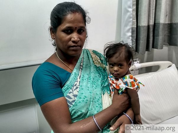 9-month-old With Down Syndrome Needs Urgent Heart Surgery