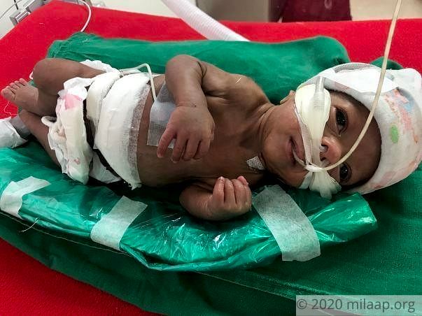 Help Vishakha and Vinayak save their premature baby boy