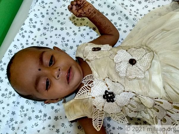 This Baby Has A Rare Birth Defect That Is Killing Her From Inside