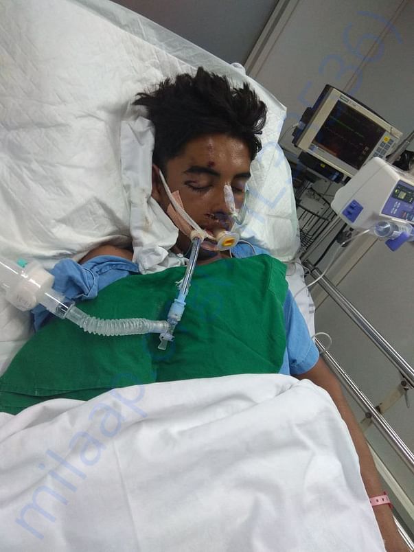 Situation when in ICU