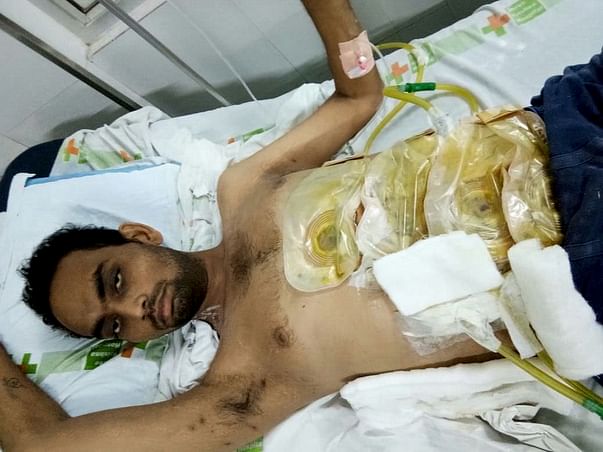Help 22-Year-Old Mehul Fight Faecal Fistula