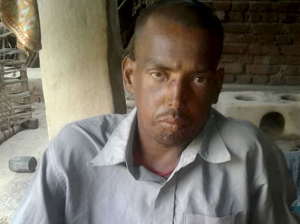 Help Pankaj (Pinku) Get Dialysis And Undergo Kidney Transplant