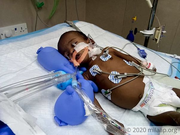 My 6-month-old Baby Has Been Fighting To Live Every Day