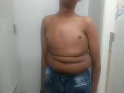 Help Shiva Fight His Spinal Cord Problem