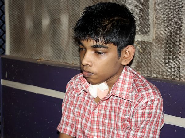 Help 16 Year Ritesh For Treatment Of Kidney Transplantation