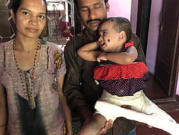 Help A 2 Year Old Suffering From Development Of Dysplasia Hip