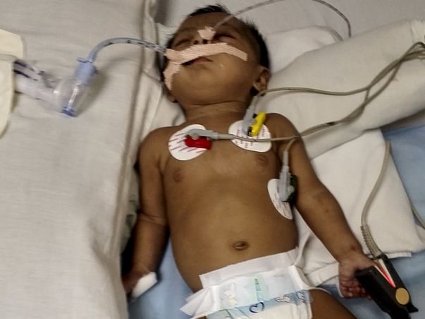Extend your support for Amara to cure her critical pneumonia with PDA