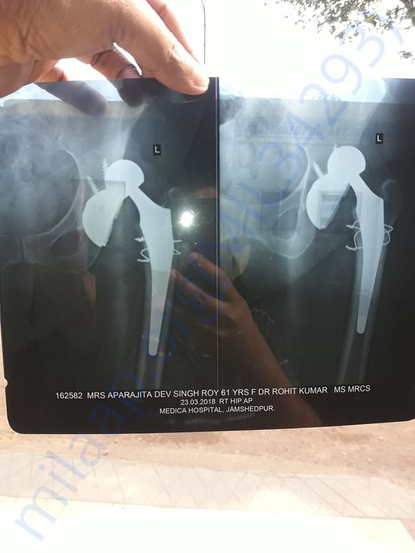 X ray 2