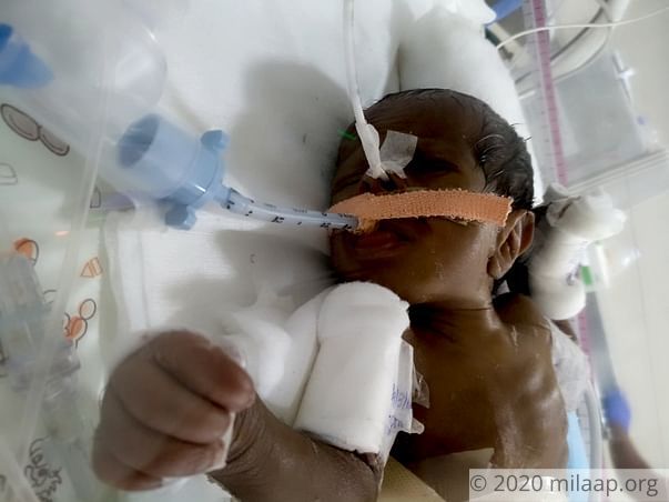 Help Revathi save her baby boy born with a blocked intestine