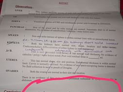 Help Juhi Undergo Kidney Transplant