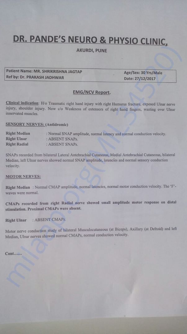 Evc report