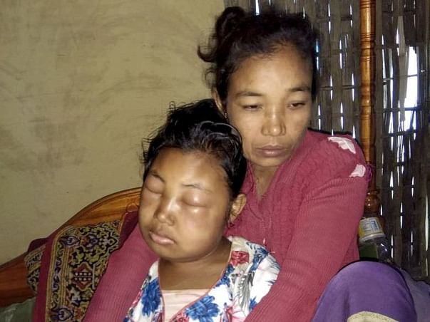 Help Kabita Rani Fight Kidney Transplant