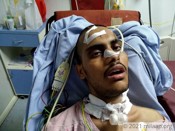No One Knew That 22-Year-Old's Chronic Headaches Were From Brain Tumor