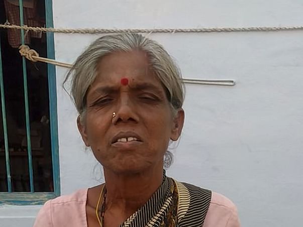 Help My Mother for ileal conduit urinary diversion Operation