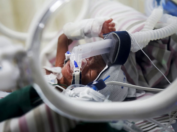 Petrol Pump Worker Races To Save 3Months Premature Born Twin Daughters