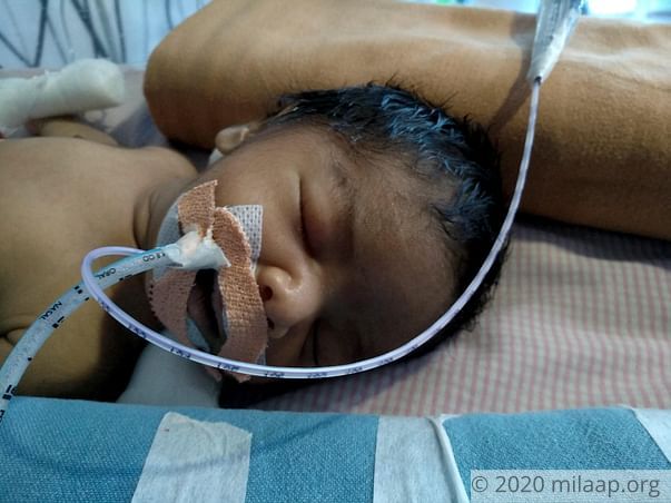 This baby is in a critical state and needs our help to live